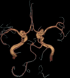 Fig. 15