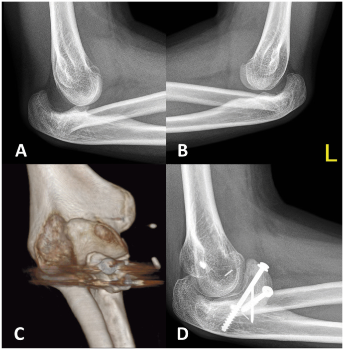 Figure 2.