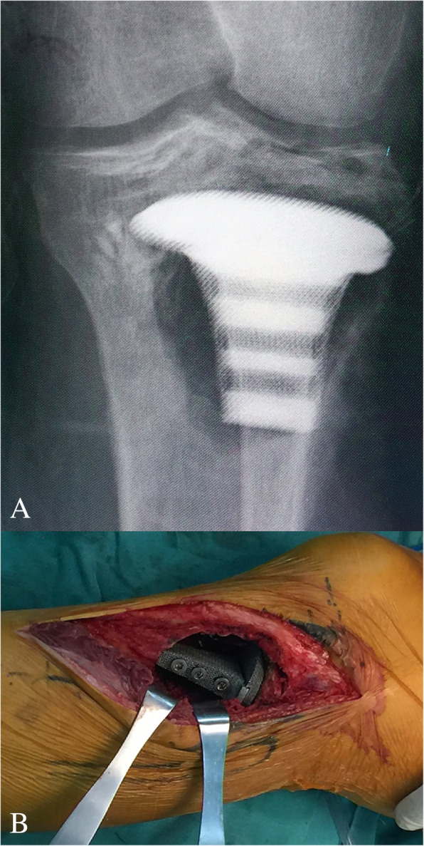 Fig. 5