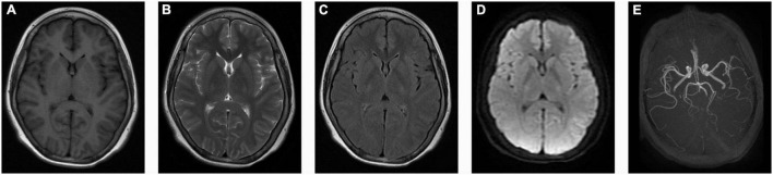 FIGURE 1