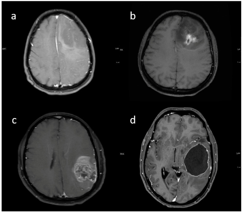 Figure 10