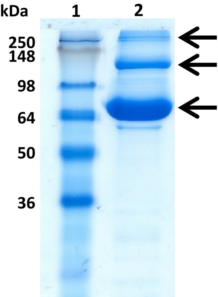 Fig. 11