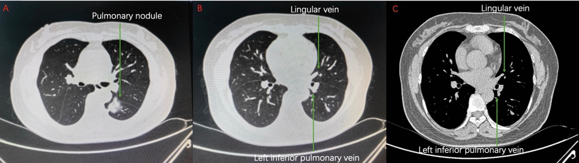 Fig. 1