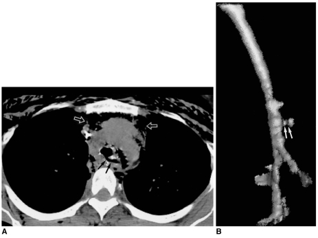 Fig. 12