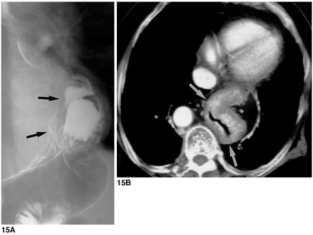 Fig. 15