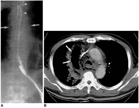 Fig. 11