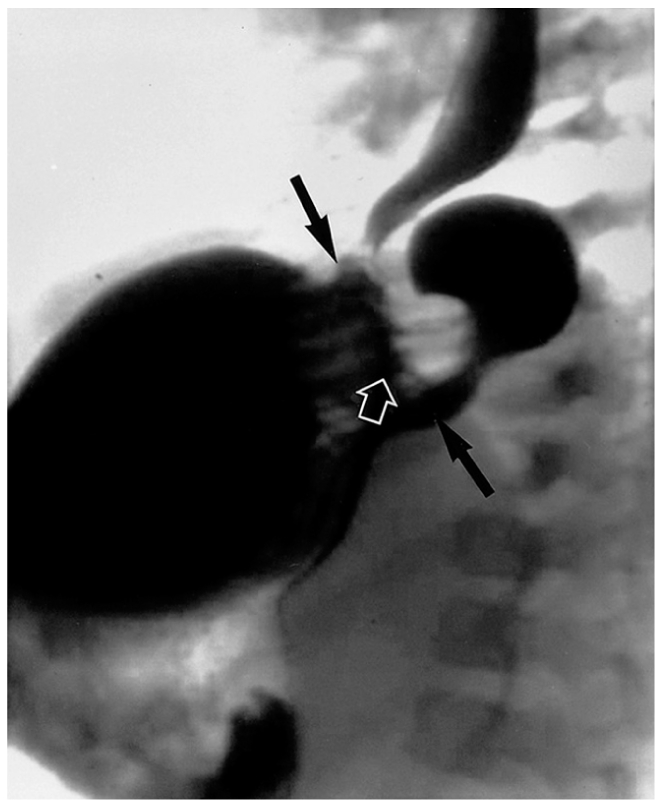 Fig. 16