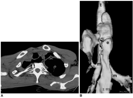 Fig. 13