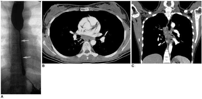 Fig. 14