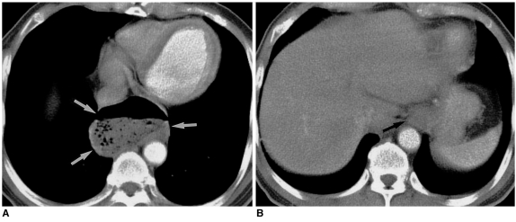 Fig. 17