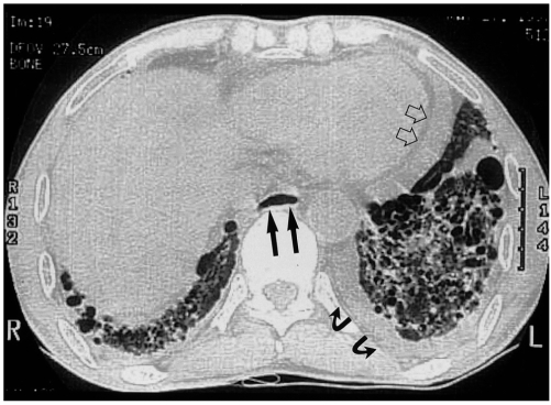 Fig. 10