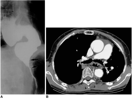 Fig. 18