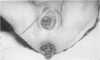75