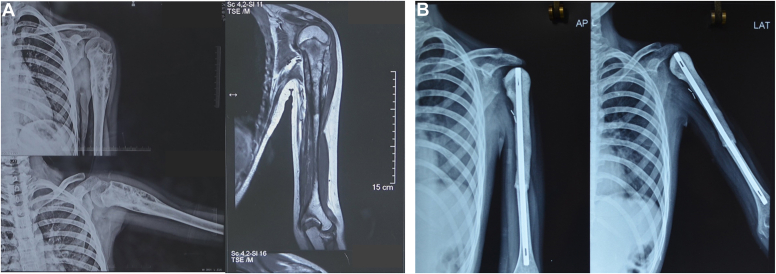 Figure 2