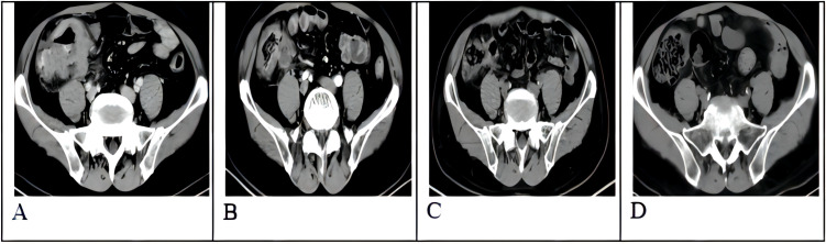 Figure 2