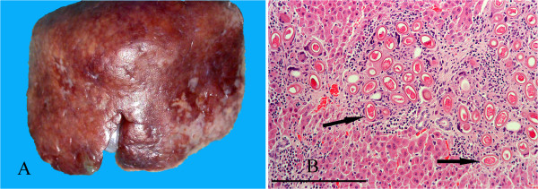 Figure 14