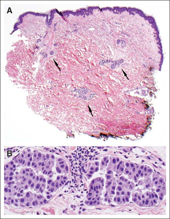 Fig 3.