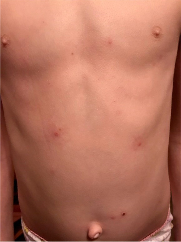Fig. 2