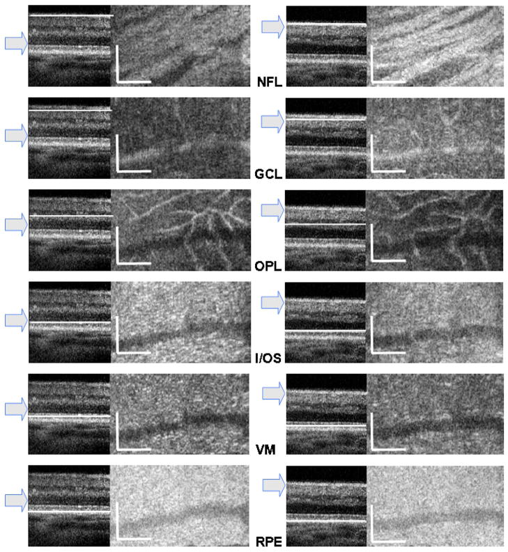 Fig. 9