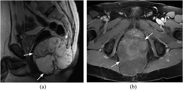 Figure 11.