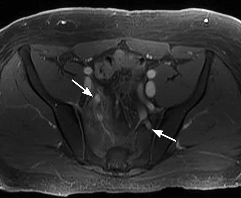 Figure 16.