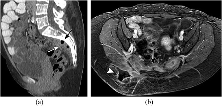 Figure 14.