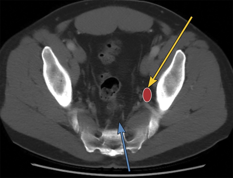 Figure 18.