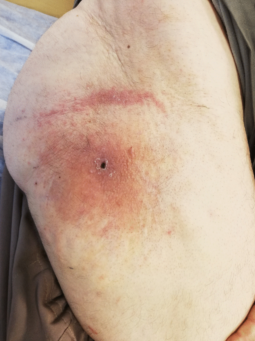 graphic file with name 13256_2023_4025_Figg_HTML.jpg