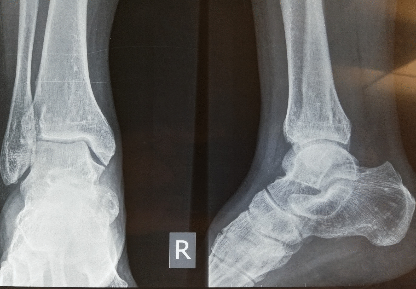 graphic file with name 13256_2023_4025_Figb_HTML.jpg