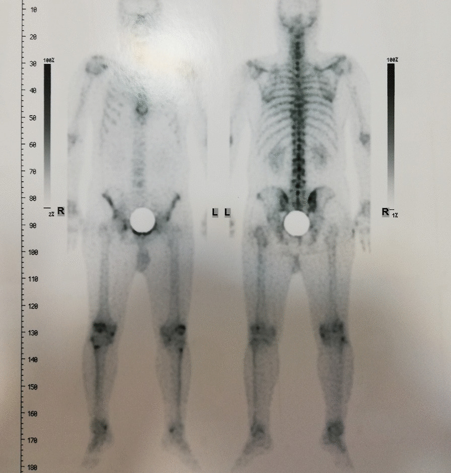 graphic file with name 13256_2023_4025_Figf_HTML.jpg