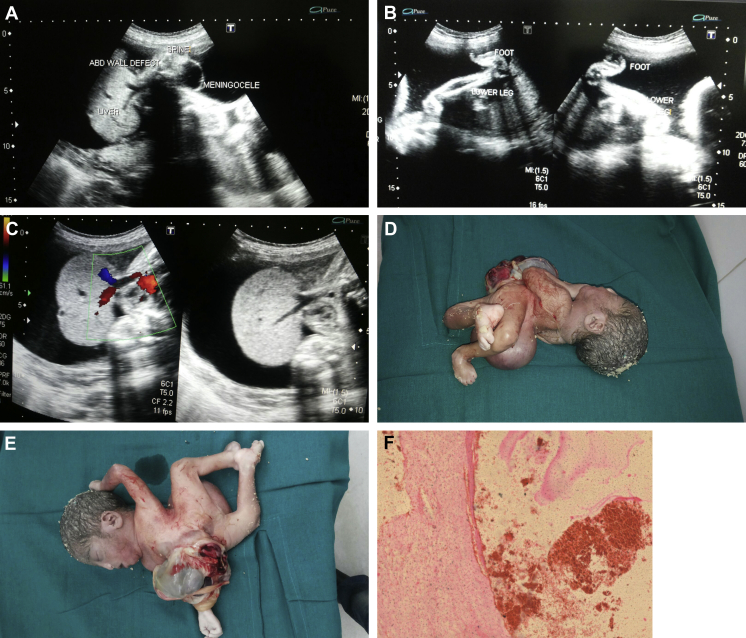 Fig. 1