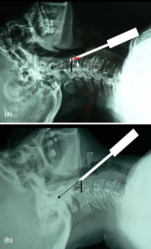 Fig. 2