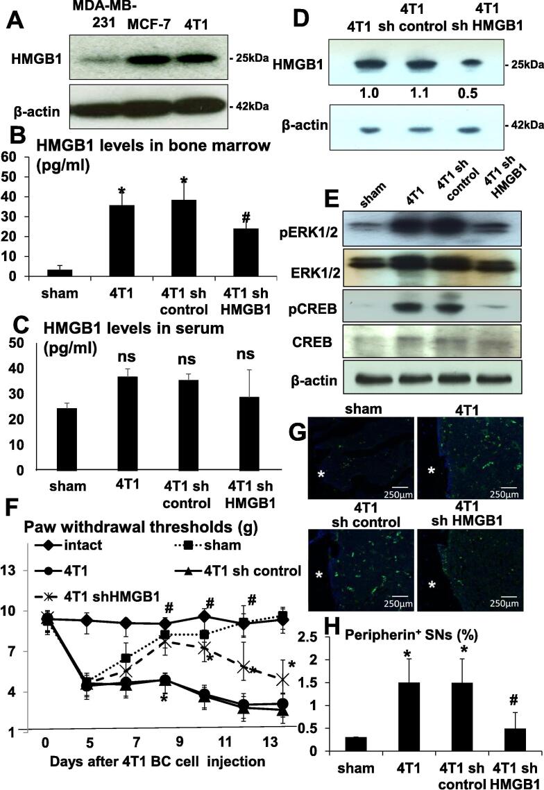 The HMGB1/RAGE axis induces bone pain associated with colonization of ...