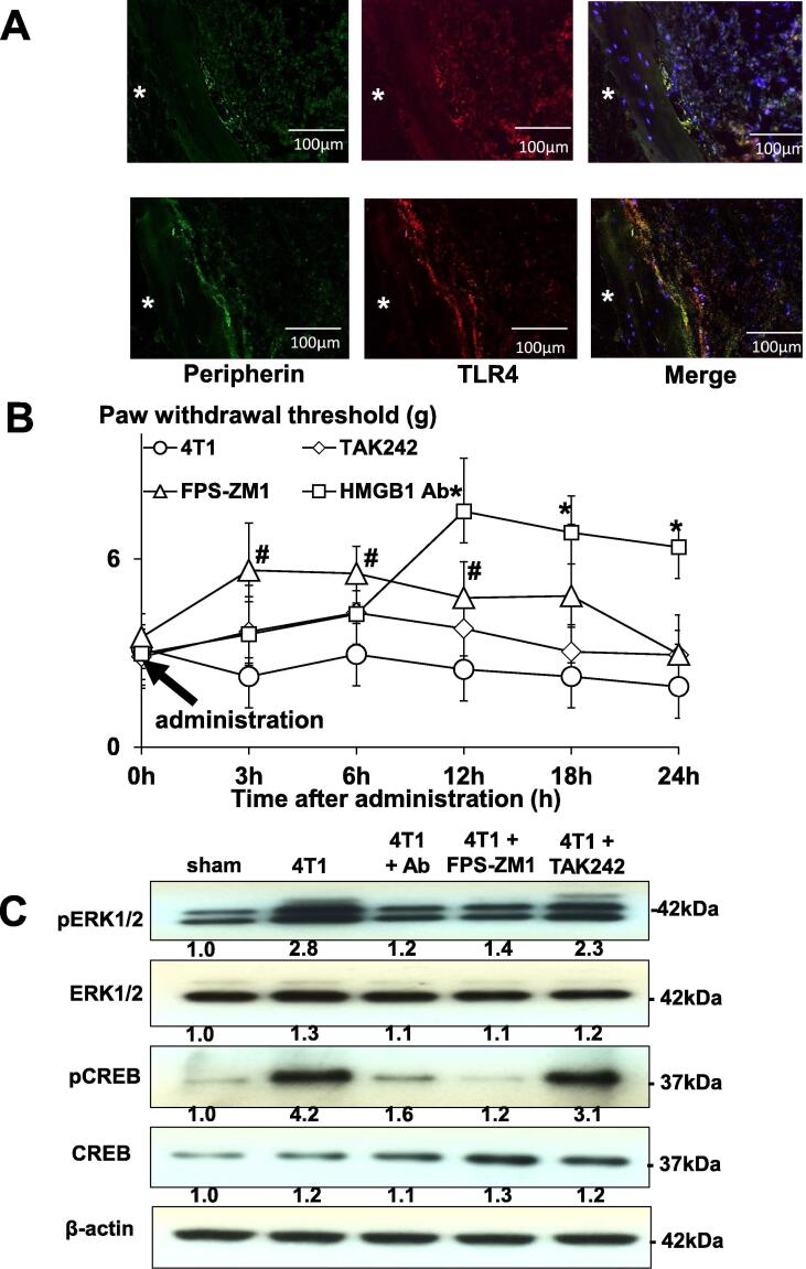 The HMGB1/RAGE axis induces bone pain associated with colonization of ...