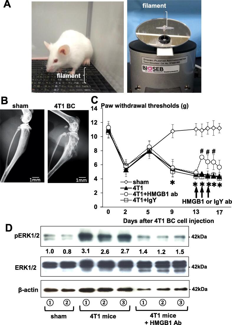 The HMGB1/RAGE axis induces bone pain associated with colonization of ...