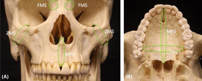 FIGURE 1