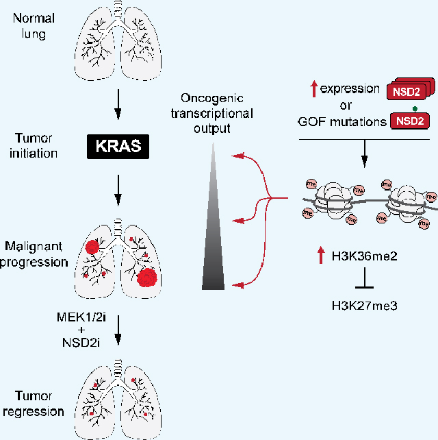 NSD2 dimethylation at H3K36 promotes lung adenocarcinoma pathogenesis - PMC