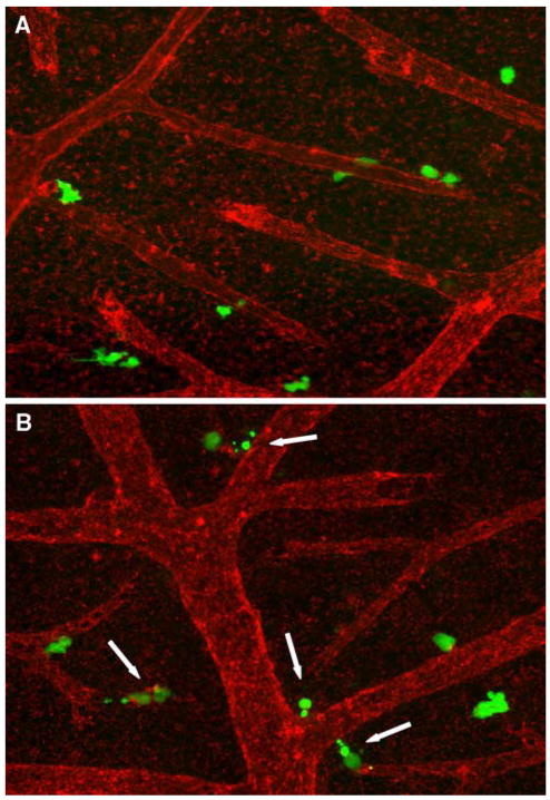 Fig. 12