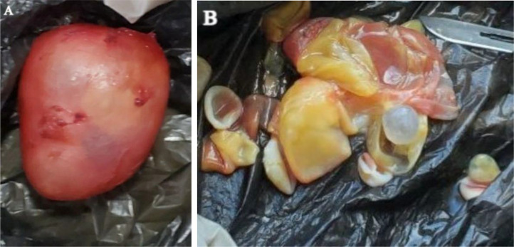 Fig 2: