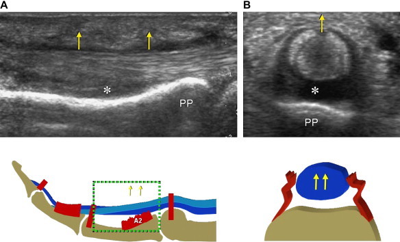 Fig. 3