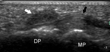 Fig. 12