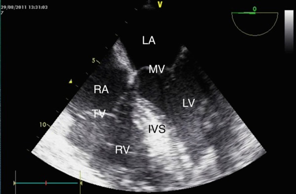 Figure 2