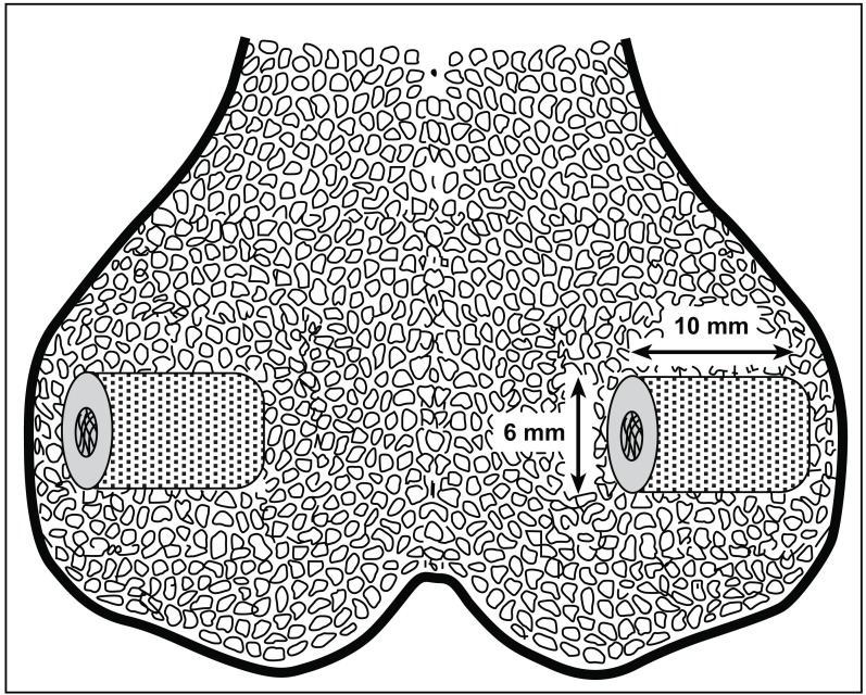 Fig. (1)