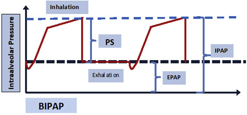 Fig. 2