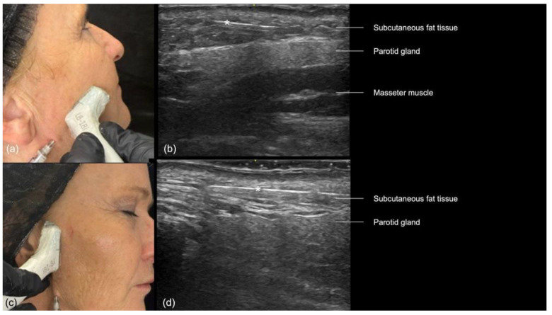 Figure 16