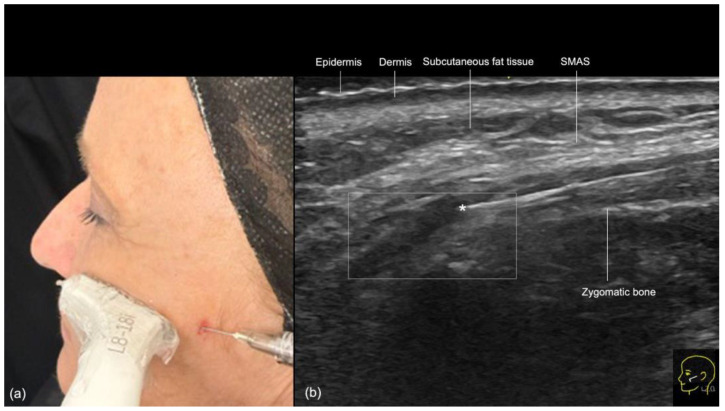 Figure 14