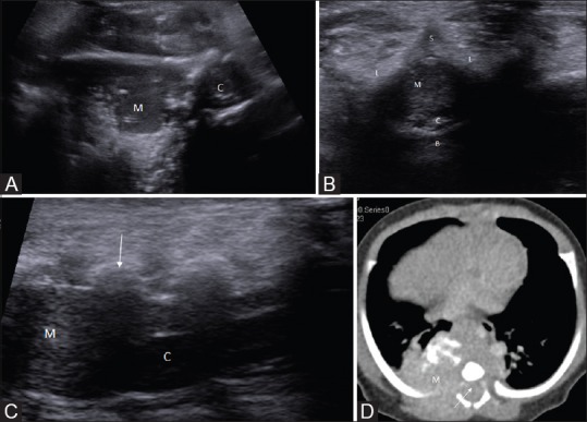 Figure 15 (A-D)