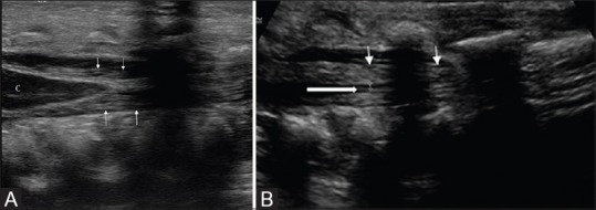 Figure 4 (A and B)