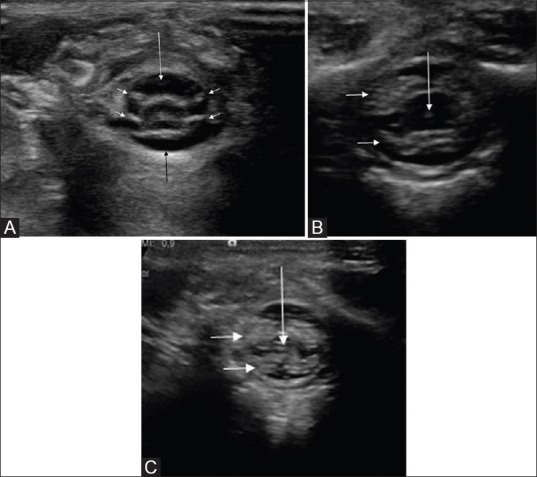 Figure 1 (A-C)