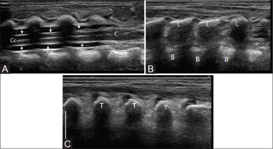 Figure 3 (A-C)